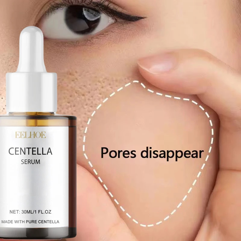 Centella Asiatica Toner - เซรั่มใบบัวบกบำรุงผิวแห้ง ผิวเรียบเนียน ฟื้นฟูผิว ครีมบำรุงผิวหน้าขาวกระจ่างใส มอยเจอร์ไรเซอร์เกาหลี