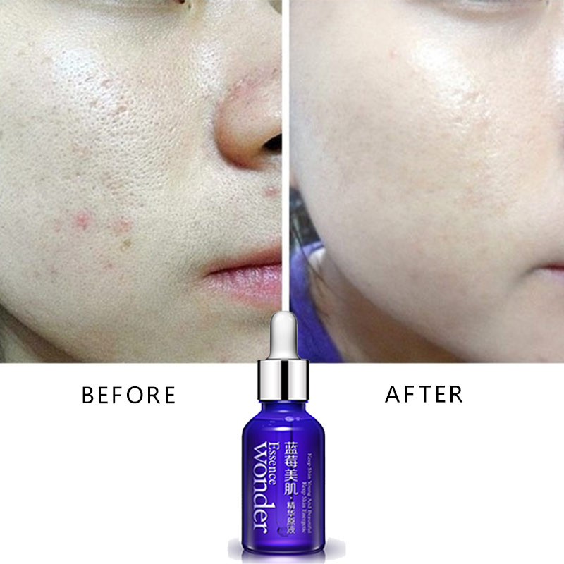 BIOAQUA บลูเบอร์รี่ Face Lifti - Skincare Garnier บทวิจารณ์และราคา
