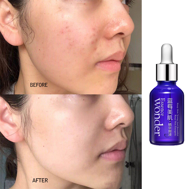BIOAQUA บลูเบอร์รี่ Face Lifti - Skincare Garnier บทวิจารณ์และราคา