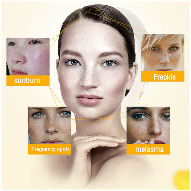 Dimollaure Whitening Freckle C - Skincare Herbal บทวิจารณ์และราคา