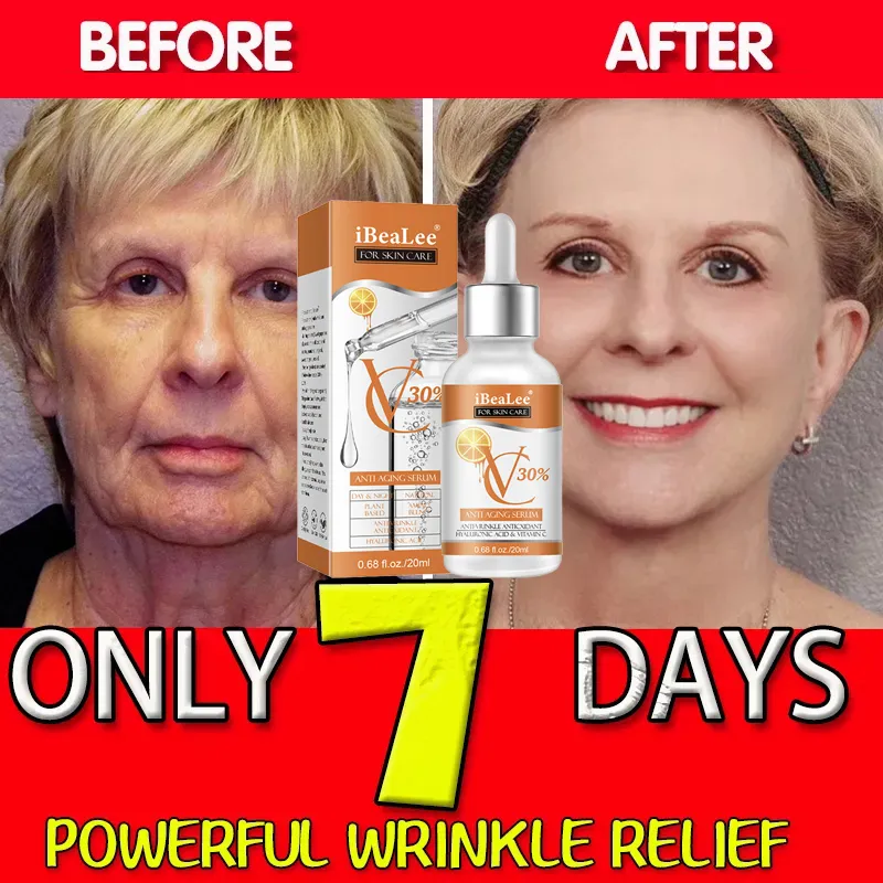 เซรั่มวิตามินซี30% พรีเมี่ยมสำ - Skincare Garnier บทวิจารณ์และราคา