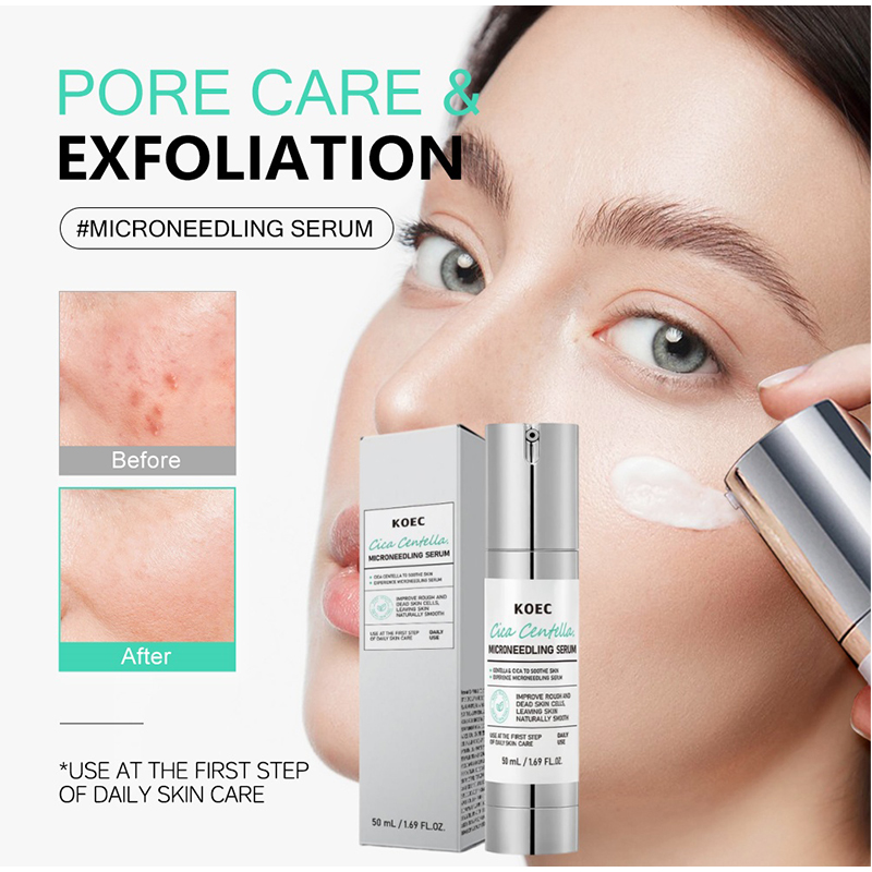 เซรั่มไมโครนีดเดิลสปิคูล, ขจัด - Centella Asiatica Toner บทวิจารณ์และราคา