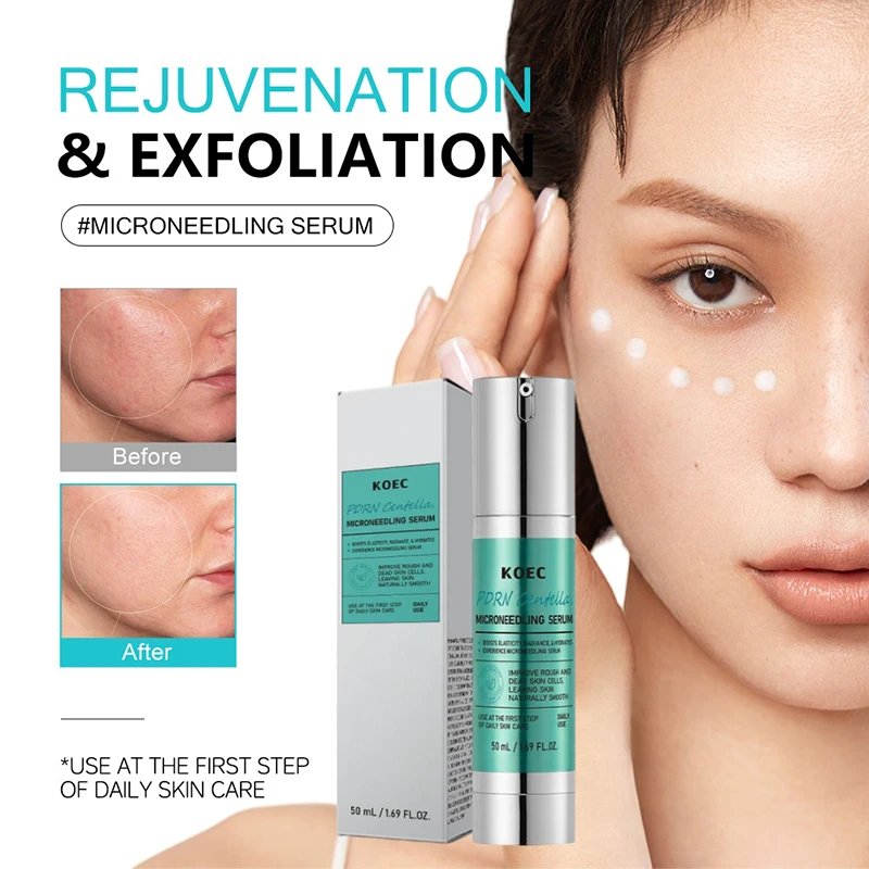 เซรั่มไมโครนีดเดิลสปิคูล, ขจัด - Centella Asiatica Toner บทวิจารณ์และราคา