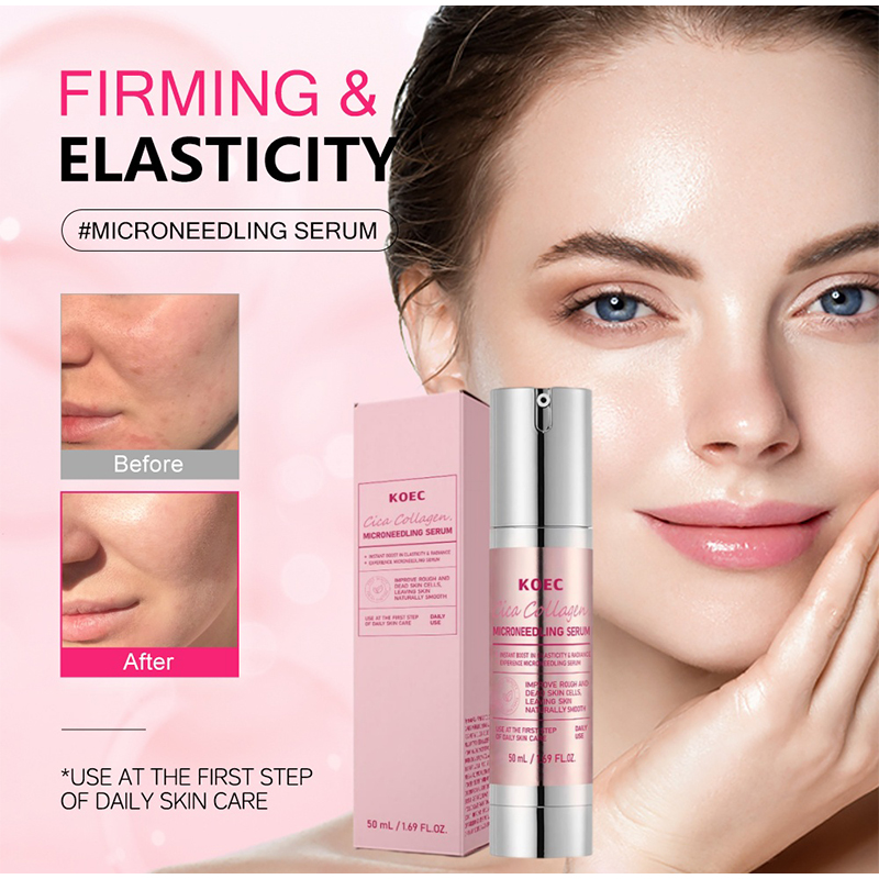 เซรั่มไมโครนีดเดิลสปิคูล, ขจัด - Centella Asiatica Toner บทวิจารณ์และราคา