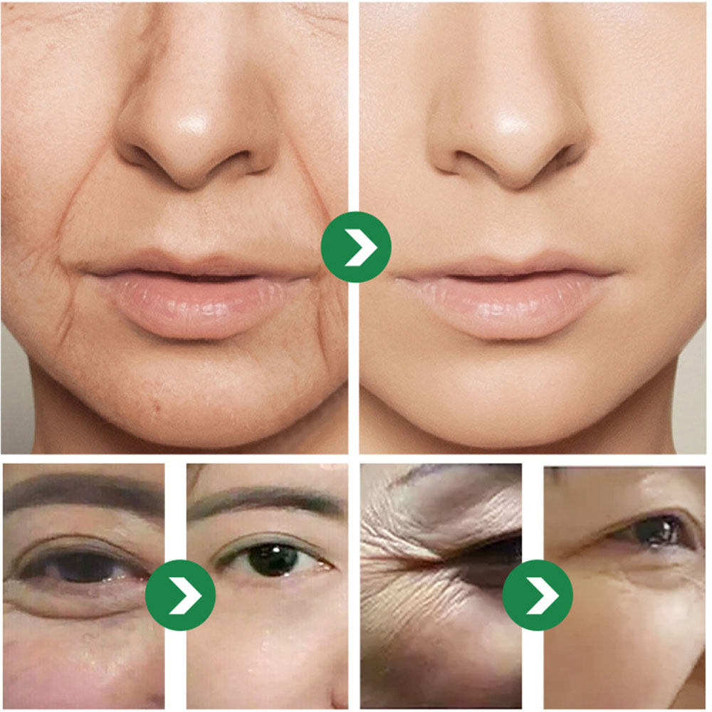 50 กรัม ครีมญี่ปุ่น ซิกซ์ เปปไ - Eye Cream Peptide บทวิจารณ์และราคา
